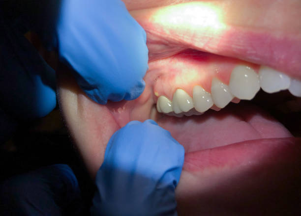 Best Tooth Infection Emergency Dentist  in Pinckney, MI